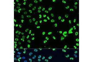 Immunofluorescence analysis of U2OS cells using DiMethyl-DNMT3A-K44 Polyclonal Antibody at dilution of 1:100. (DNMT3A Antikörper  (2meLys44))