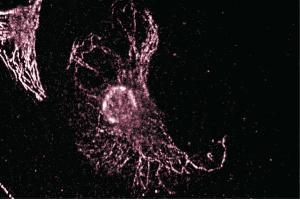 Immunofluorescent staining of NRK cells.