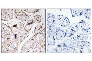 Immunohistochemistry analysis of paraffin-embedded human placenta tissue using PHCA antibody. (ACER3 Antikörper  (Internal Region))