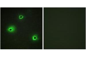 Immunofluorescence analysis of A549 cells, using GRAH Antibody. (GZMH Antikörper  (AA 51-100))