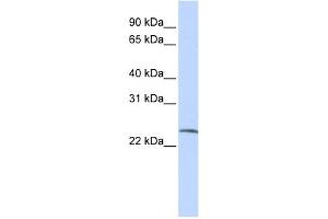WB Suggested Anti-SSX6 Antibody Titration:  0.