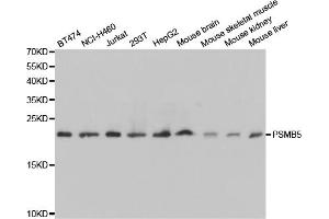 Western blot analysis of extracts of various cell lines, using PSMB5 antibody (ABIN5971025) at 1/1000 dilution.