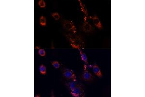 Immunofluorescence (IF) image for anti-Mechanistic Target of Rapamycin (serine/threonine Kinase) (mTOR) (AA 2400-2500) antibody (ABIN6144170)