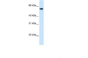 WB Suggested Anti-FTCD Antibody  Titration: 1. (FTCD Antikörper  (N-Term))