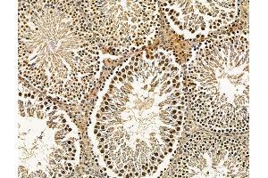 ABIN7096114 and ABIN7100176 at 1/100 staining rat testis tissue by IHC-P. (PYM Antikörper)