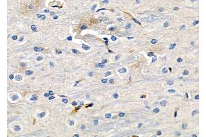 ABIN6257242 and ABIN6273630 at 1/100 staining Rat brain tissue by IHC-P. (GRIP1 Antikörper  (Internal Region))