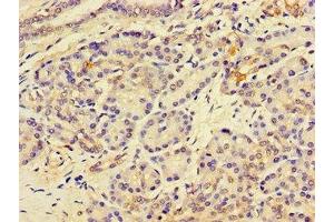 Immunohistochemistry of paraffin-embedded human pancreatic tissue using ABIN7158760 at dilution of 1:100 (LPCAT3 Antikörper  (AA 306-363))