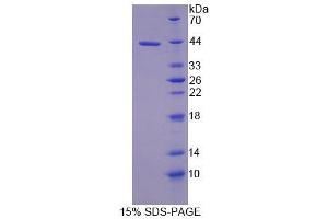 SDS-PAGE (SDS) image for Ubiquinol-Cytochrome C Reductase Binding Protein (UQCRB) (AA 4-111) protein (His tag,GST tag) (ABIN6239176)
