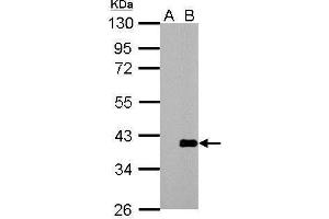 Western Blotting (WB) image for anti-Actin Related Protein 2/3 Complex, Subunit 1A, 41kDa (ARPC1A) (N-Term) antibody (ABIN2855928)