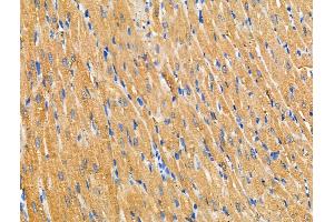 ABIN6257638 and ABIN6274781 at 1/100 staining Rat heart tissue by IHC-P. (RPL36 Antikörper  (C-Term))