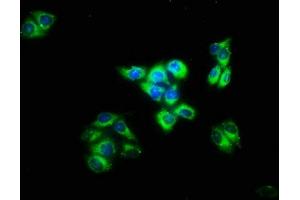 Immunofluorescence staining of Hela cells with ABIN7156945 at 1:133, counter-stained with DAPI. (IMPG2 Antikörper  (AA 616-759))