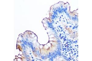 Immunohistochemistry of paraffin-embedded human appendix using CE Rabbit mAb (ABIN7266083) at dilution of 1:100 (40x lens). (CEACAM1 Antikörper)