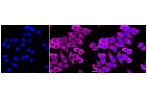 anti-Nucleosome Assembly Protein 1-Like 1 (NAP1L1) antibody
