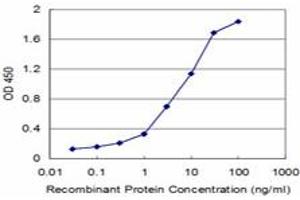 Detection limit for recombinant GST tagged UMPS is approximately 0. (UMPS Antikörper  (AA 381-479))