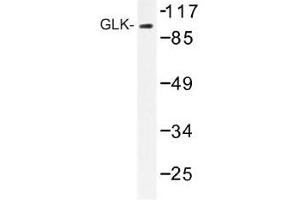 Image no. 1 for anti-Mitogen-Activated Protein Kinase Kinase Kinase Kinase 3 (MAP4K3) antibody (ABIN317719)