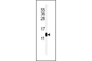 Western blot analysis of DC13 Antibody (N-term) (ABIN651108 and ABIN2840074) in mouse kidney tissue lysates (35 μg/lane). (C16orf61 Antikörper  (N-Term))