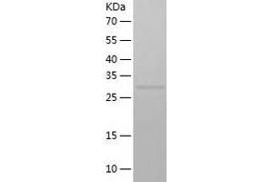 Western Blotting (WB) image for Guanine Nucleotide Binding Protein (G Protein), beta Polypeptide 2-Like 1 (GNB2L1) (AA 1-317) protein (His tag) (ABIN7123240) (GNB2L1 Protein (AA 1-317) (His tag))