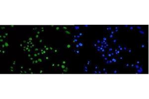 IF analysis of TPR using anti-TPR antibody (ABIN7603243). (TPR Antikörper  (N-Term))