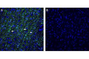 Expression of Vasopressin V1A Receptor in rat frontal cortex. (AVPR1A Antikörper  (Intracellular))