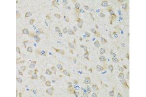 Immunohistochemistry (Paraffin-embedded Sections) (IHC (p)) image for anti-Chloride Channel, Voltage-Sensitive 7 (CLCN7) antibody (ABIN7262785)