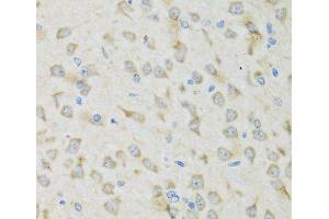 Immunohistochemistry of paraffin-embedded Mouse brain using CLCN7 Polyclonal Antibody at dilution of 1:100 (40x lens). (CLCN7 Antikörper)