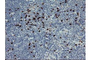 Image no. 3 for anti-GTPase, IMAP Family Member 4 (GIMAP4) antibody (ABIN1498460)