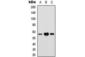 Western blot analysis of IRF5 expression in HEK293T (A), Raw264. (IRF5 Antikörper  (Center))