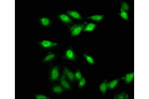 Immunofluorescence staining of Hela cells with ABIN7144009 at 1:66, counter-stained with DAPI. (AMMECR1 Antikörper  (AA 146-248))