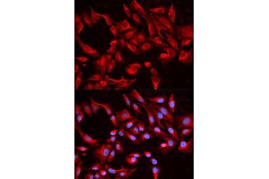 Immunofluorescence analysis of HeLa cells using BCL2L13 antibody (ABIN5970460).