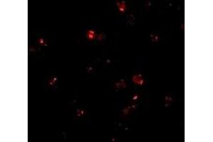 Immunofluorescence (IF) image for anti-Presenilin Enhancer 2 Homolog (PSENEN) (C-Term) antibody (ABIN1030574) (PEN2 Antikörper  (C-Term))