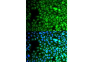 Immunofluorescence analysis of A549 cells using ZNF195 antibody. (ZNF195 Antikörper  (AA 1-250))