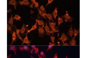Immunofluorescence analysis of C6 cells using HSD17B1 Polyclonal Antibody at dilution of 1:100 (40x lens). (HSD17B1 Antikörper)