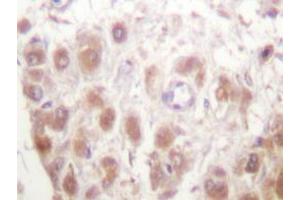 Immunohistochemistry analyzes of Rad52 antibody in paraffin-embedded human testis tissue. (RAD52 Antikörper)