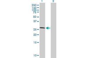 Western Blot analysis of ASB7 expression in transfected 293T cell line by ASB7 MaxPab polyclonal antibody. (ASB7 Antikörper  (AA 1-274))
