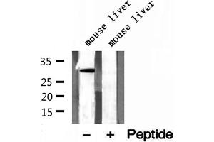 Western blot analysis of extracts of mouse liver tissue, using GNMT antibody.