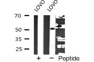 Western blot analysis of hnRNP K expression in LOVO cells (HNRNPK Antikörper  (Internal Region))