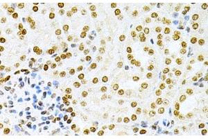 Immunohistochemistry of paraffin-embedded Mouse kidney using DKC1 Polyclonal Antibody at dilution of 1:200 (40x lens). (DKC1 Antikörper)