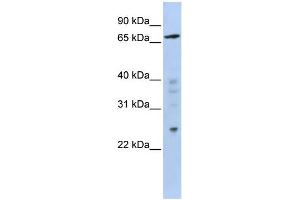 WB Suggested Anti-ZNF510 Antibody Titration:  0. (ZNF510 Antikörper  (Middle Region))