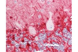 Human Brain, Cerebellum: Formalin-Fixed, Paraffin-Embedded (FFPE). (GLUL Antikörper  (AA 301-350))