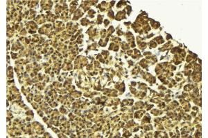 ABIN6269410 at 1/100 staining Mouse pancreas tissue by IHC-P. (IKBKG Antikörper  (N-Term))