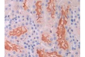 Immunohistochemistry (IHC) image for anti-Endoglin (ENG) (AA 26-136) antibody (ABIN7432976)