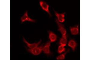 ABIN6276168 staining HeLa by IF/ICC. (OR5F1 Antikörper  (C-Term))