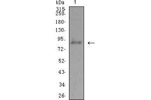 Western Blotting (WB) image for anti-ADAM Metallopeptidase with Thrombospondin Type 1 Motif, 1 (ADAMTS1) (AA 858-960) antibody (ABIN5542559)