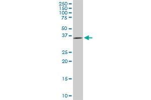 Western Blotting (WB) image for anti-Decapping Enzyme, Scavenger (DCPS) (AA 1-338) antibody (ABIN466201) (DCPS Antikörper  (AA 1-338))