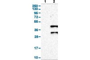 Western Blot analysis of (1) Negative control (vector only transfected HEK293T lysate), and (2) Over-expression lysate (Co-expressed with a C-terminal myc-DDK tag (~3.