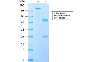 SDS-PAGE Analysis Purified IL-10 Recombinant Rabbit Monoclonal Antibody (IL10/2651R). (Rekombinanter IL-10 Antikörper)