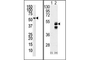 Image no. 1 for anti-Protein Phosphatase 1F (PP2C Domain Containing) (PPM1F) (N-Term) antibody (ABIN360800) (PPM1F Antikörper  (N-Term))