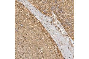 IHC analysis of Sm-D3/SNRPD3 using anti-Sm-D3/SNRPD3 antibody (ABIN7598952).