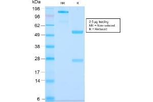 SDS-PAGE Analysis Purified MUC3 Rabbit Recombinant Monoclonal Antibody (MUC3/2992R). (Rekombinanter MUC3A Antikörper)