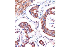 Immunohistochemistry (IHC) image for anti-Malic Enzyme 3, NADP(+)-Dependent, Mitochondrial (ME3) (AA 505-604) antibody (ABIN7268384)